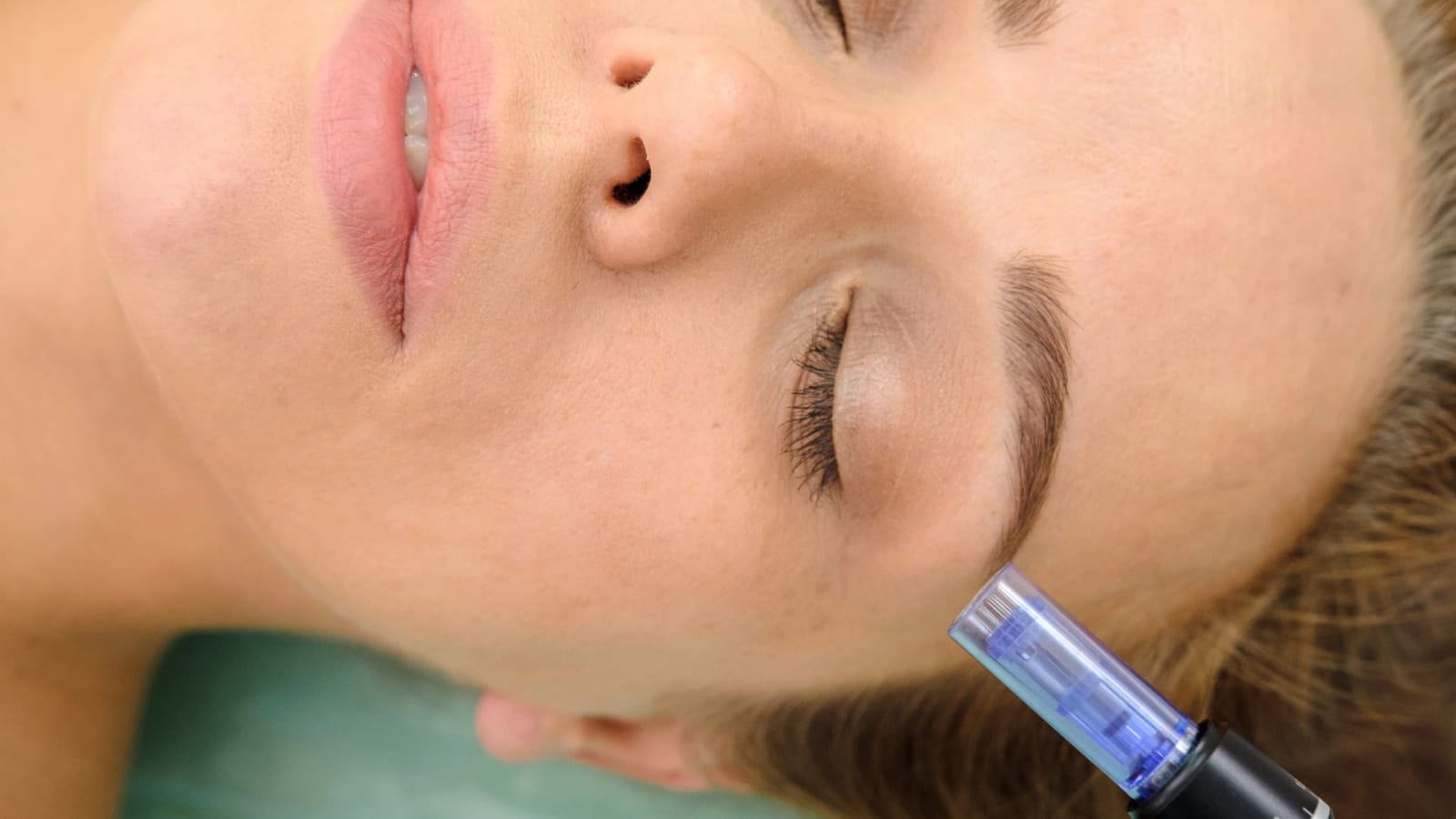 Amplecare - doctor-led aesthetics and wellness clinic in Birkirkara, photo 8