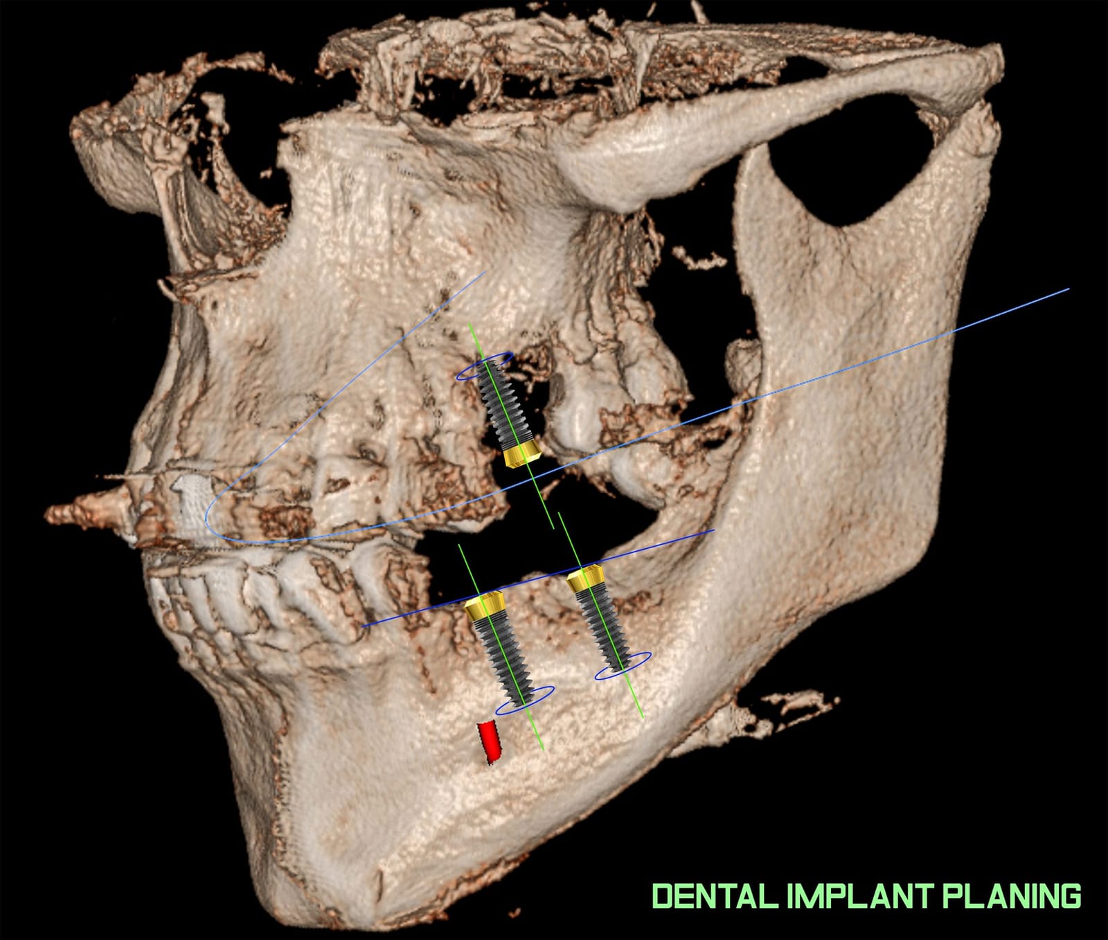 Apex Dental - private dental clinics and implants in Birkirkara, photo 13