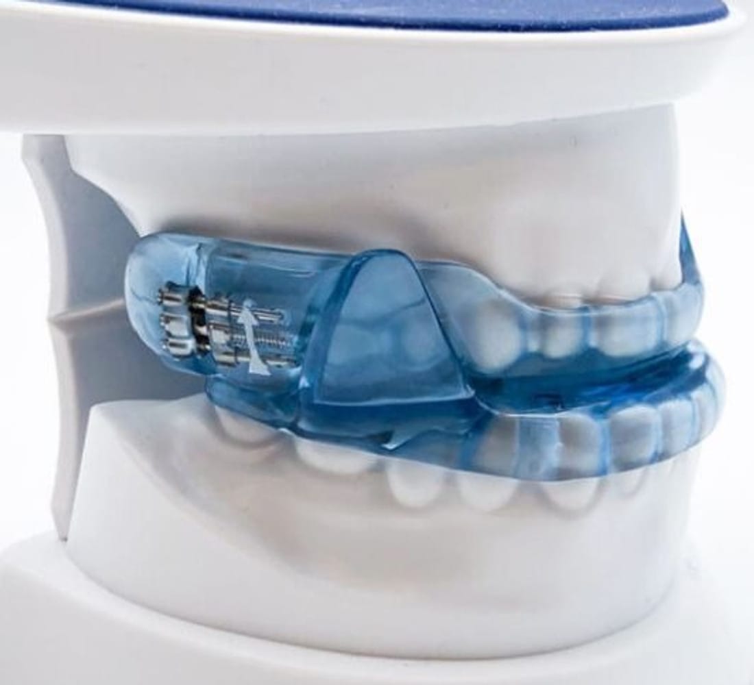 Dr Emad Deen Orthodontics - specialist orthodontist and braces in Naxxar, photo 11
