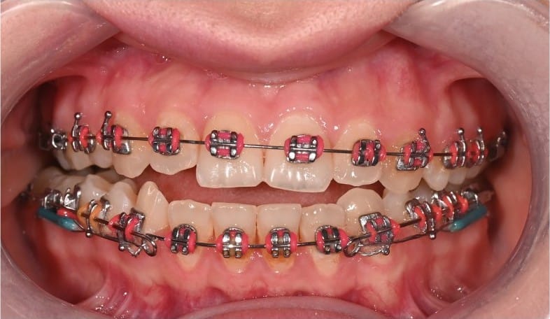 Dr Emad Deen Orthodontics - specialist orthodontist and braces in Naxxar, photo 12