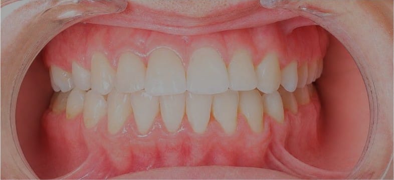 Dr Emad Deen Orthodontics - specialist orthodontist and braces in Naxxar, photo 13