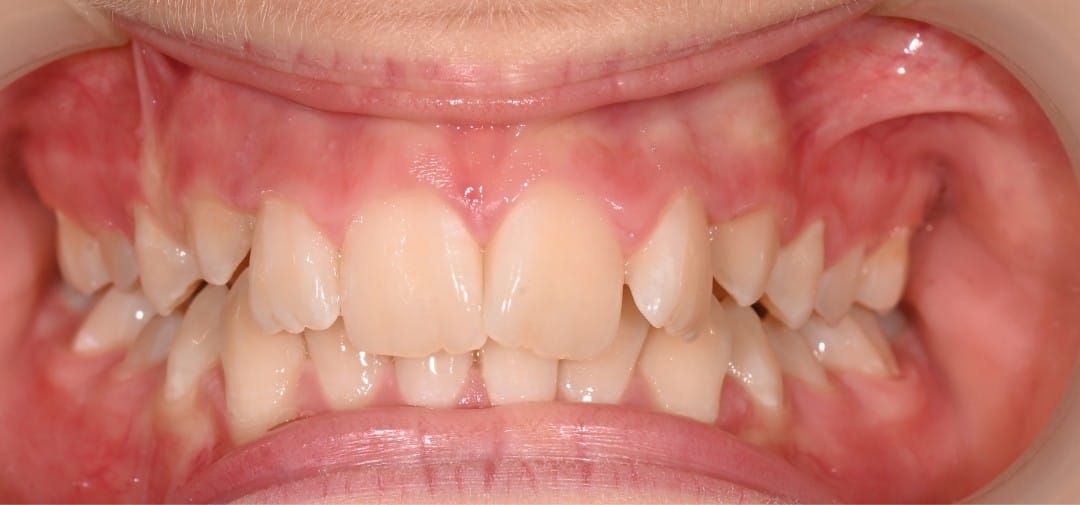 Dr Emad Deen Orthodontics - specialist orthodontist and braces in Naxxar, photo 14