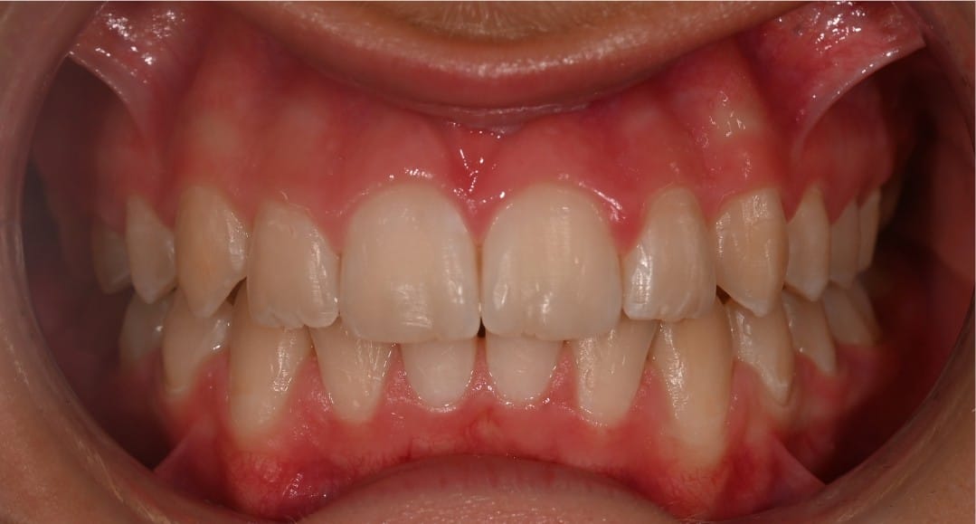 Dr Emad Deen Orthodontics - specialist orthodontist and braces in Naxxar, photo 15