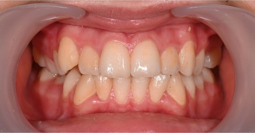 Dr Emad Deen Orthodontics - specialist orthodontist and braces in Naxxar, photo 16