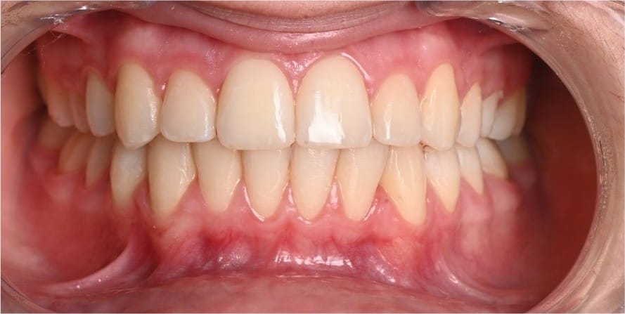 Dr Emad Deen Orthodontics - specialist orthodontist and braces in Naxxar, photo 17