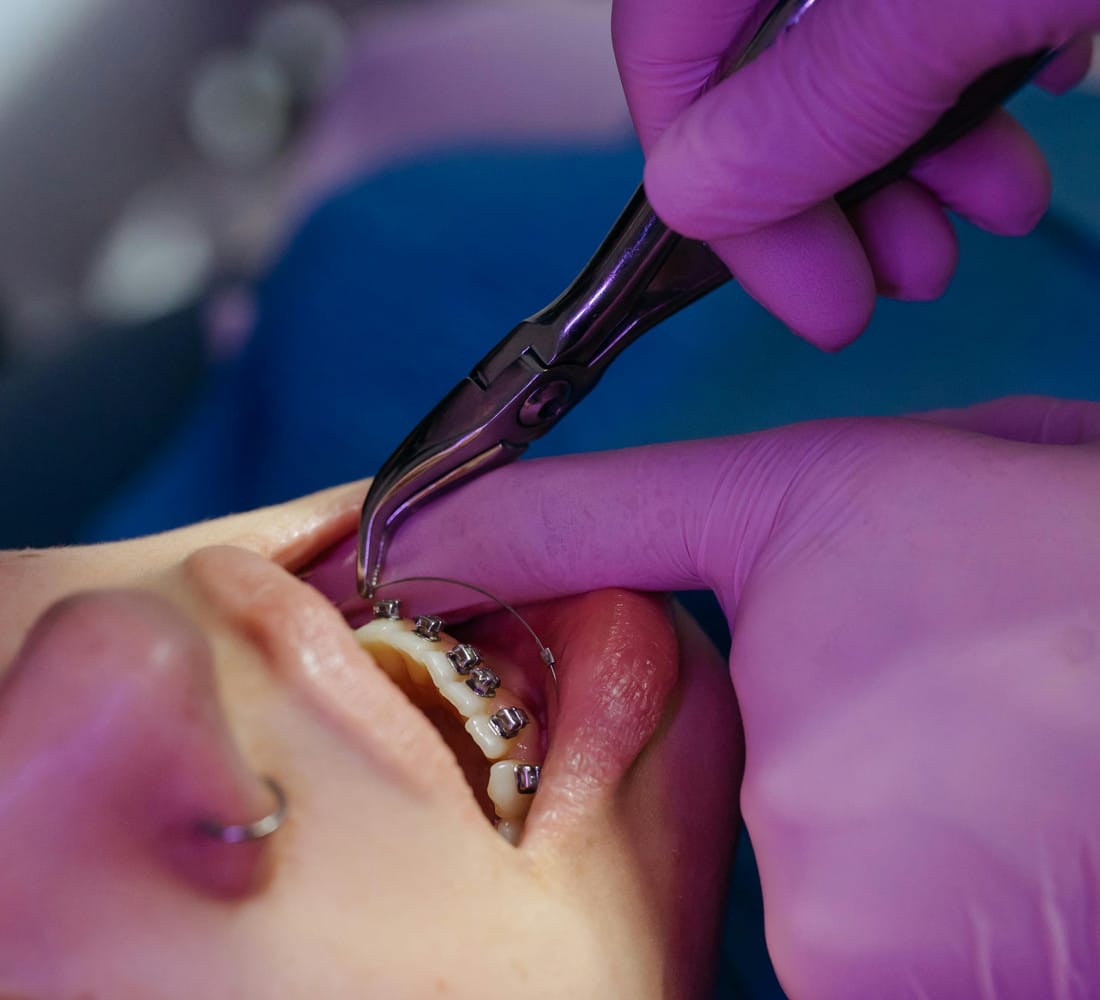 Dr Emad Deen Orthodontics - specialist orthodontist and braces in Naxxar, photo 4