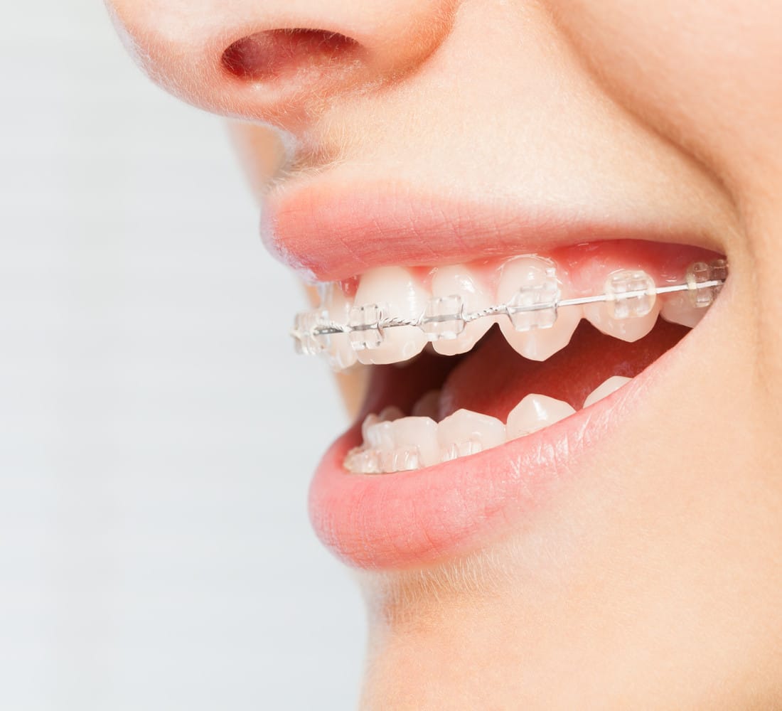 Dr Emad Deen Orthodontics - specialist orthodontist and braces in Naxxar, photo 5