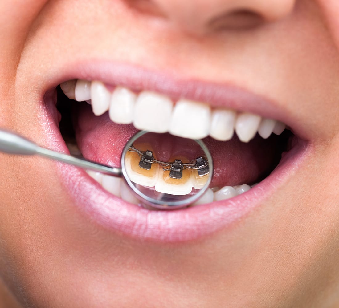 Dr Emad Deen Orthodontics - specialist orthodontist and braces in Naxxar, photo 6