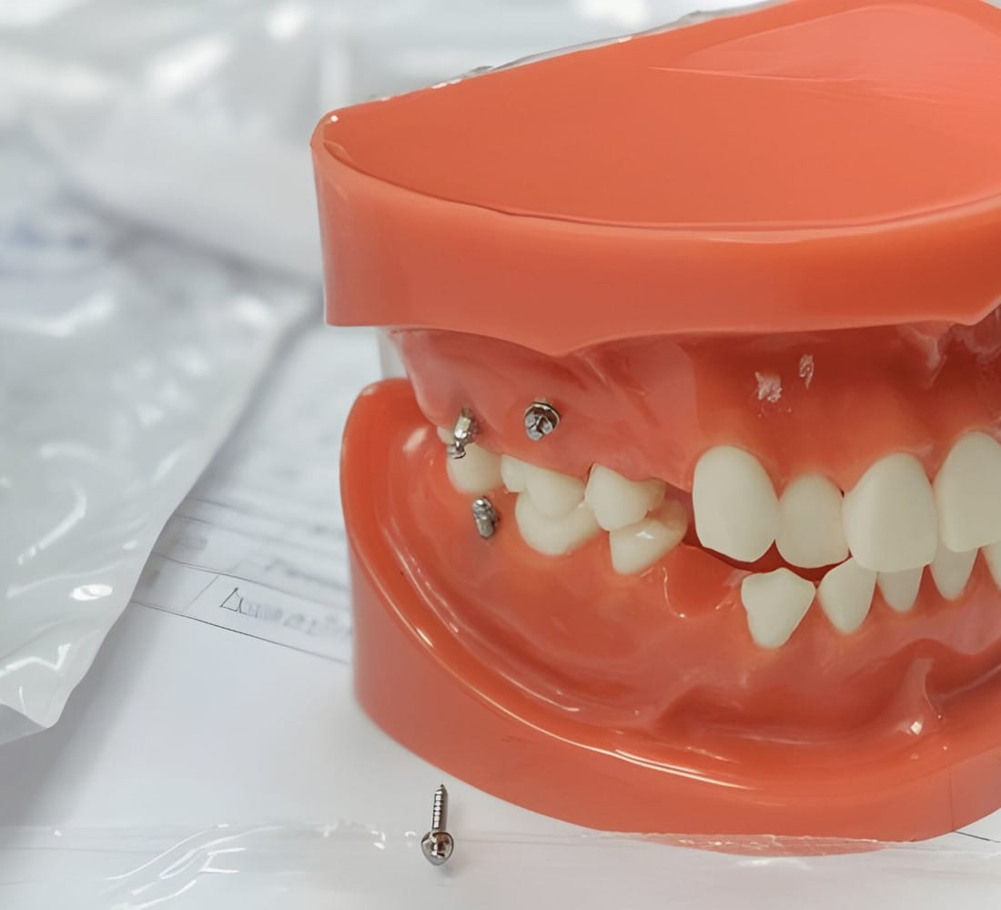 Dr Emad Deen Orthodontics - specialist orthodontist and braces in Naxxar, photo 8