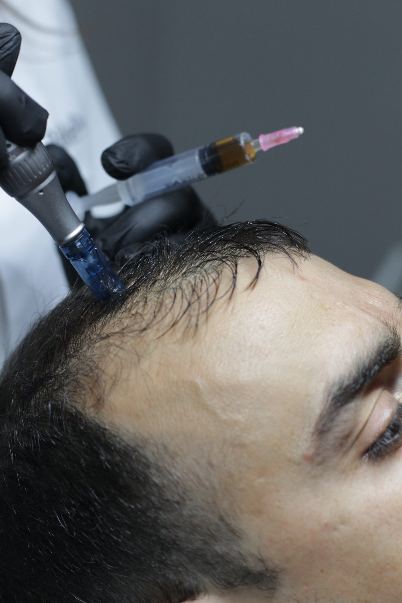 Pure Aesthetics Malta - scalp and hair clinic in Birkirkara, photo 3