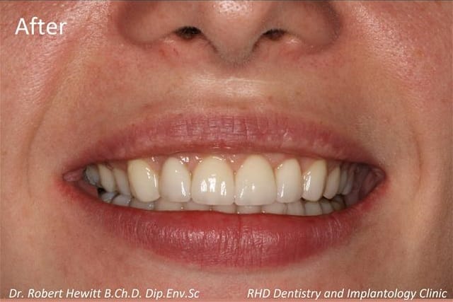 RHD Dentistry and Implantology - dentistry and implant clinic in Paola, photo 3