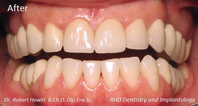 RHD Dentistry and Implantology - dentistry and implant clinic in Paola, photo 4