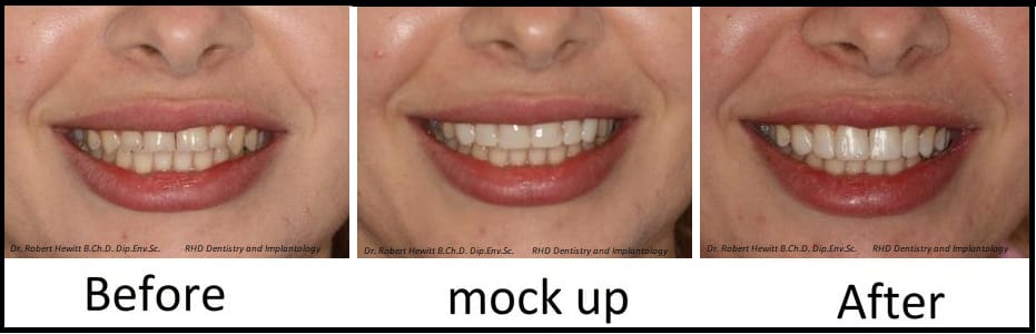RHD Dentistry and Implantology - dentistry and implant clinic in Paola, photo 5