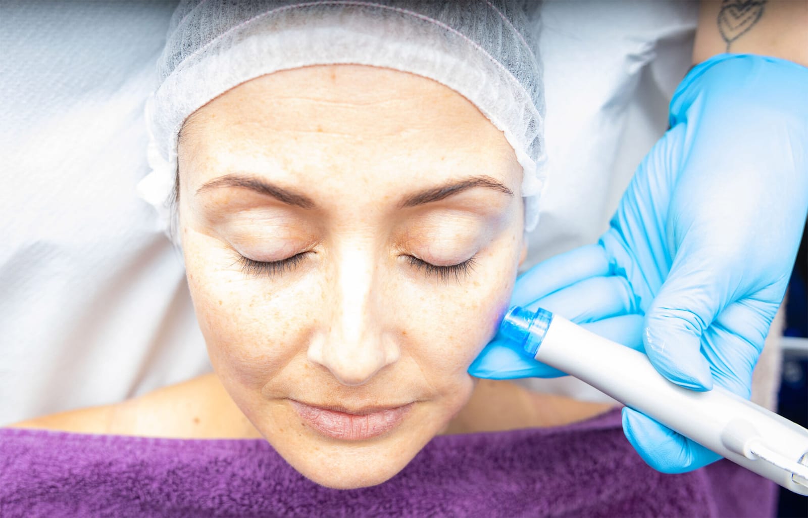 The DermaCare Clinic - laser hair removal and beauty clinic in Ħamrun, photo 5