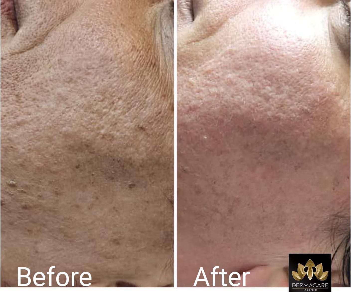 The DermaCare Clinic - laser hair removal and beauty clinic in Ħamrun, photo 8