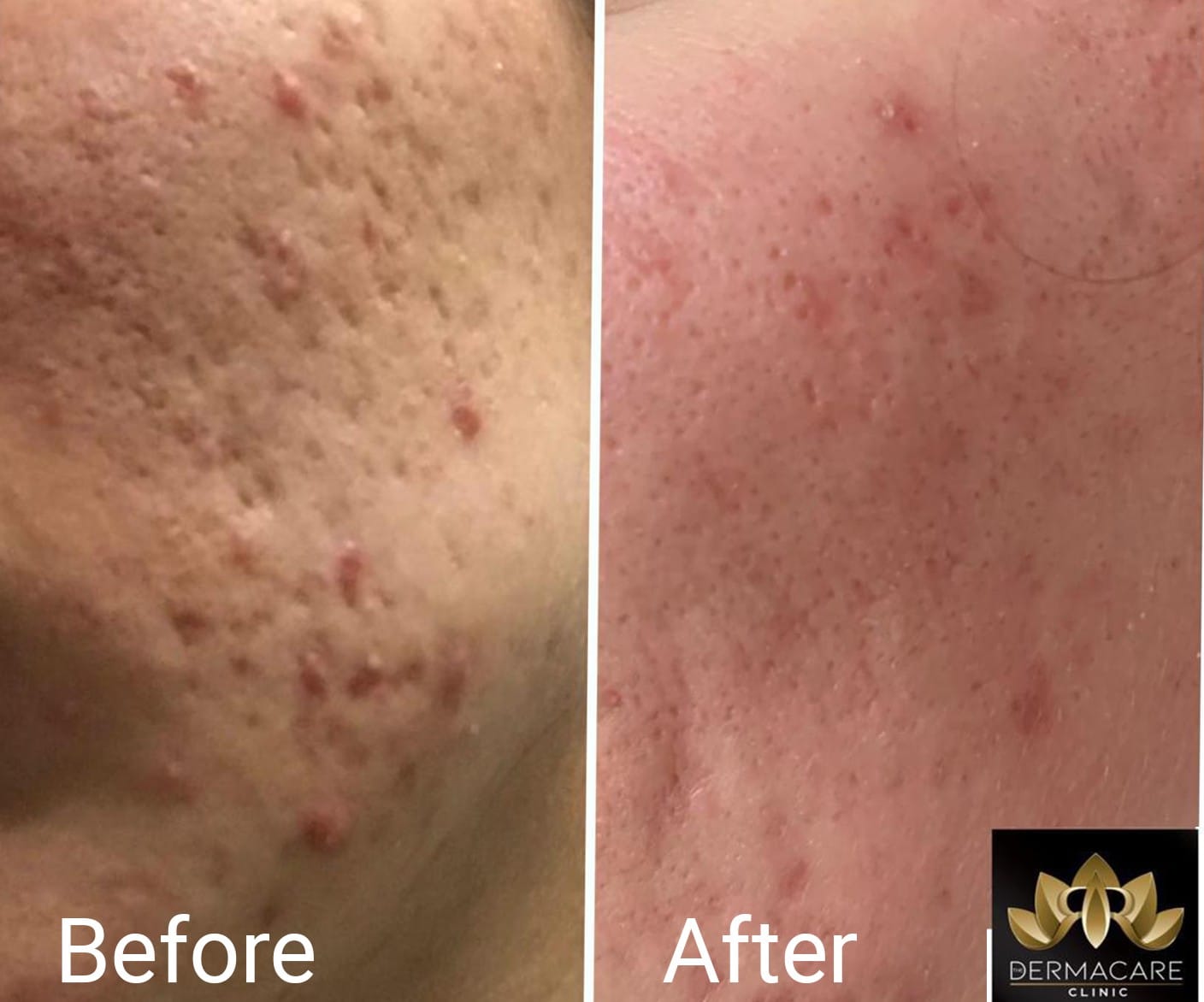 The DermaCare Clinic - laser hair removal and beauty clinic in Ħamrun, photo 9